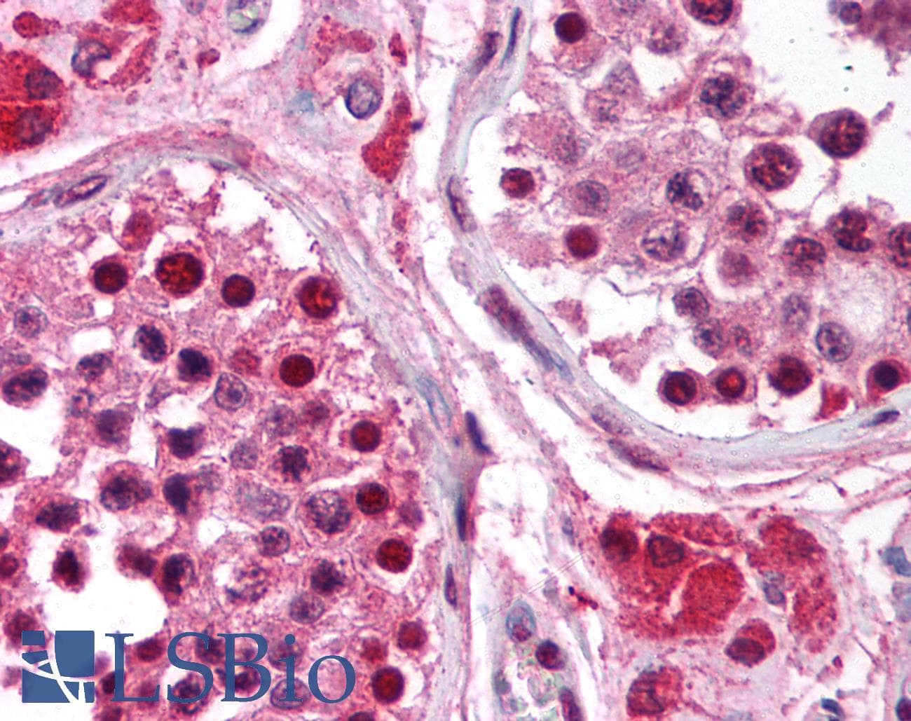 IHC-plus™ RPA3 Antibody (clone 111)