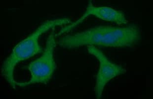 TGFB1 / TGF Beta 1 Antibody (clone OTI1E12)