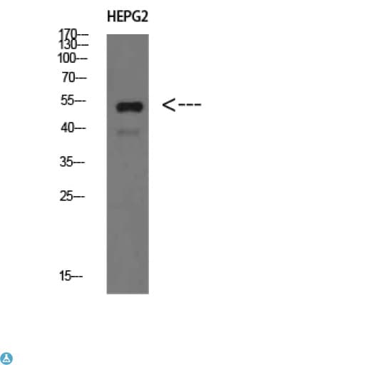 Polyclonal Rabbit anti-Human IGHM / IgM Antibody (WB)