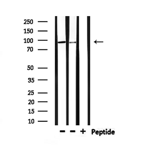 Polyclonal Rabbit anti-Human HMG-CoA Reductase / HMGCR Antibody (IHC, WB)