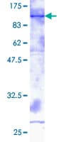 Human ADAM2 / Fertilin Beta Protein (Recombinant GST)