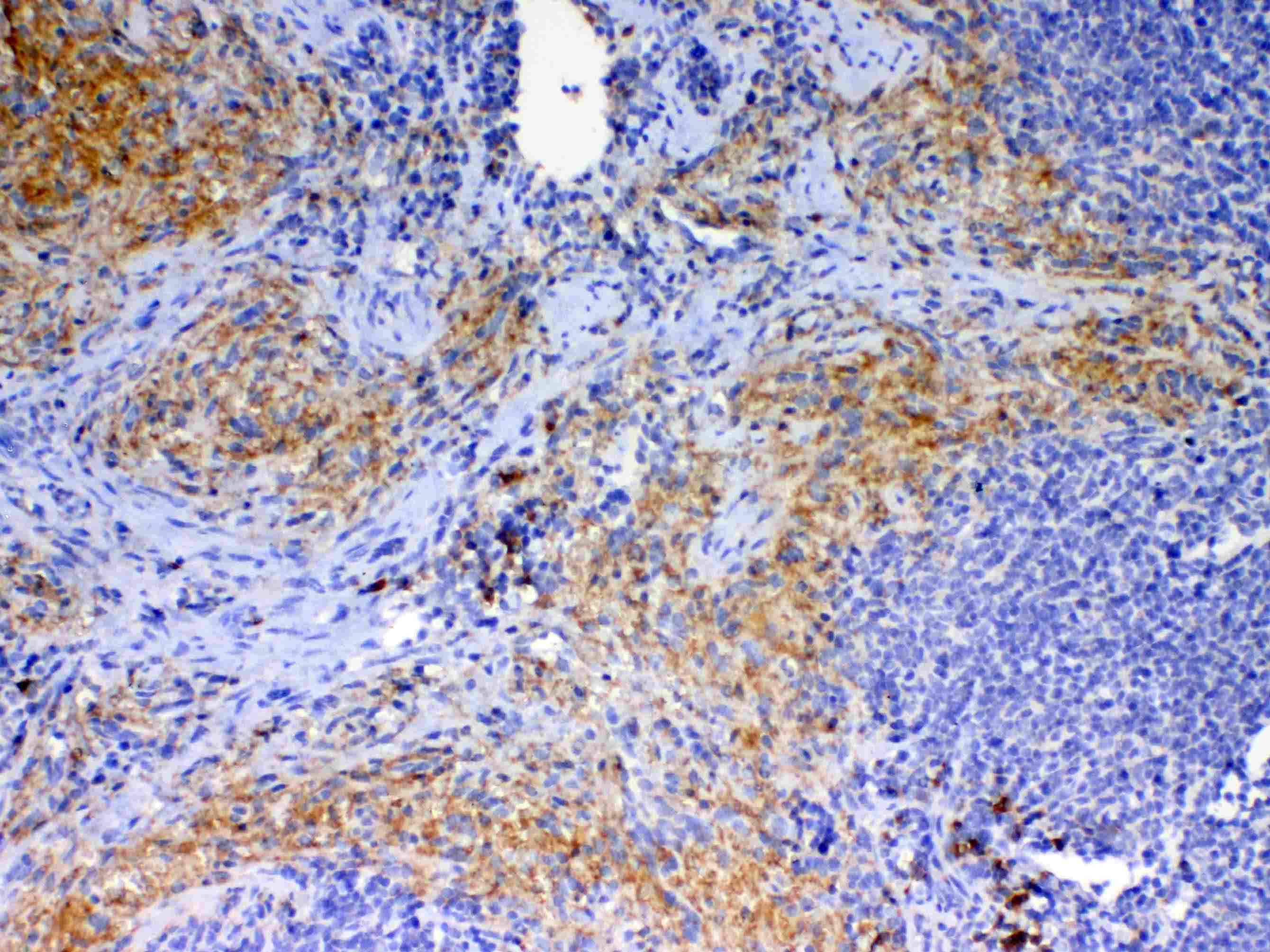 CD40L Antibody