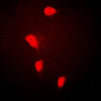 SLIM / FHL1 Antibody
