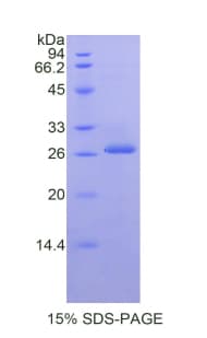Mouse KLK3 / PSA Protein (Recombinant His)
