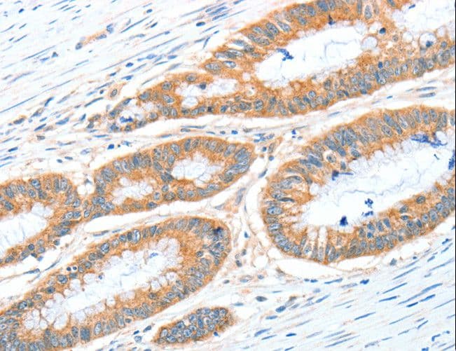 RALDH2 / ALDH1A2 Antibody