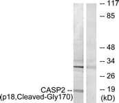 CASP2 / Caspase 2 Antibody (aa151-200)