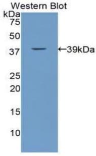 Calcitonin Antibody (aa25-85)