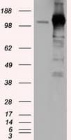 Monoclonal Mouse anti-Human ERIC-1 / TACC3 Antibody (clone OTI6F1, IHC, IF, WB)