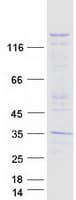 Human NALP1 / NLRP1 Protein (Recombinant Myc-DDK (Flag))