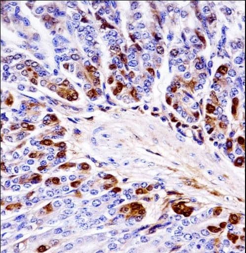 Polyclonal Rabbit anti-Mouse PRKCB / PKC-Beta Antibody (aa1-30, IHC, WB)