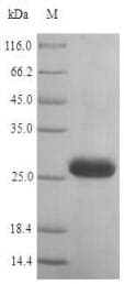 Human HSP90AB1 / HSP90 Alpha B1 Protein (Recombinant 10His, N-terminus + Myc, C-terminus)