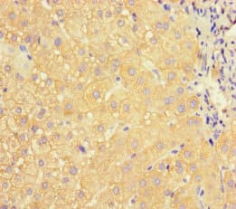 APOC3 / Apolipoprotein C III Antibody