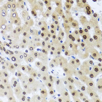 RAD23B / HR23B Antibody