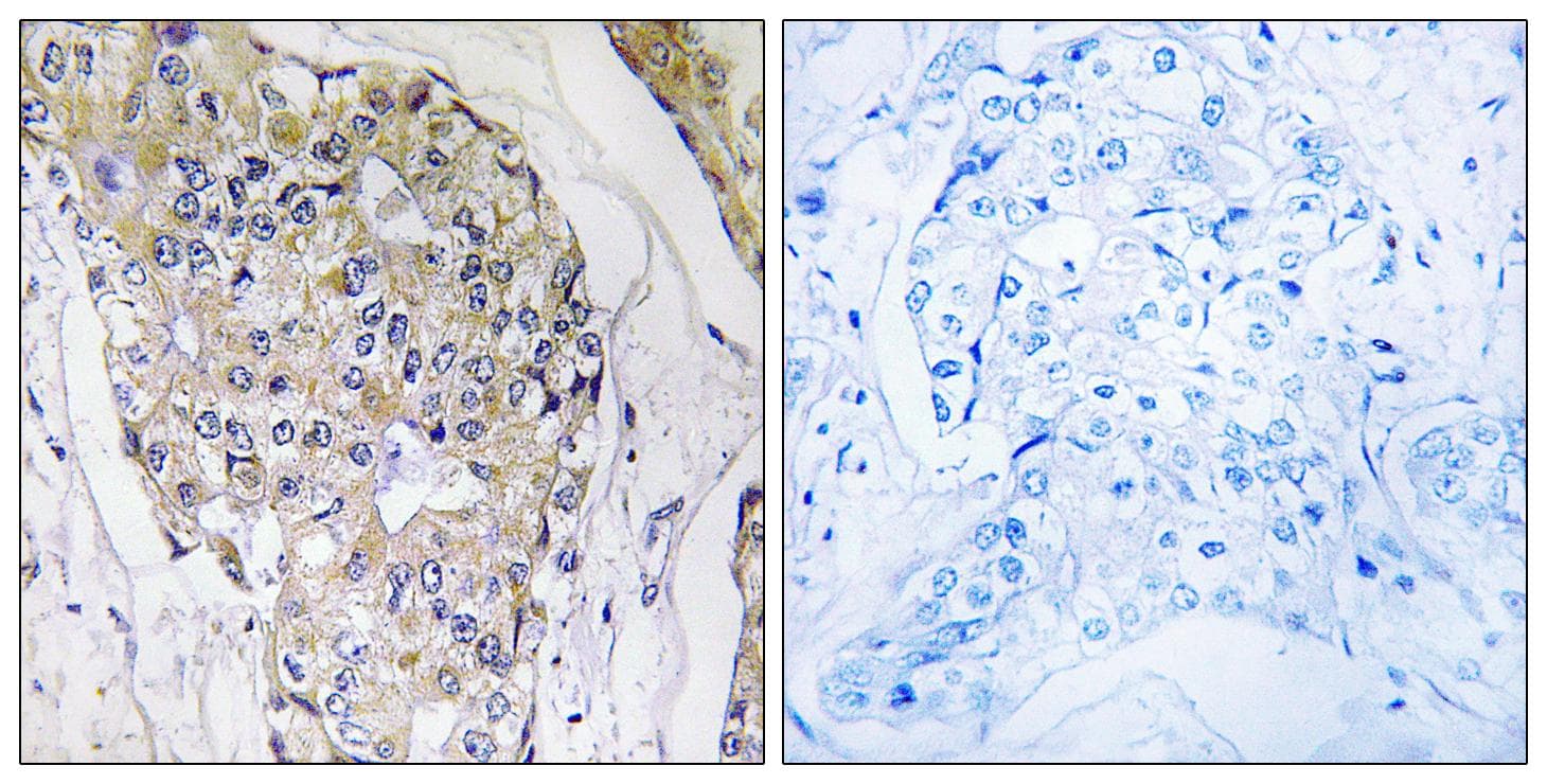 Polyclonal Rabbit anti-Human NDUFS6 Antibody (IHC)