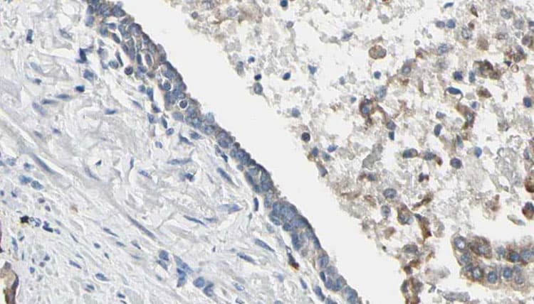 PIK3CA / PI3K Alpha Antibody