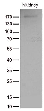 ACE / CD143 Antibody (aa642-1230, clone OTI2C8)