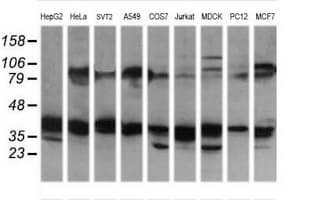 MAP2K3 / MEK3 / MKK3 Antibody (clone OTI6F8)