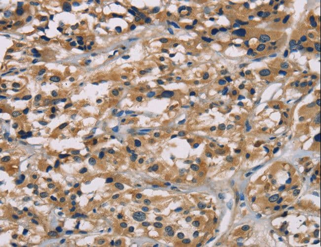 hCG / Chorionic Gonadotropin Antibody