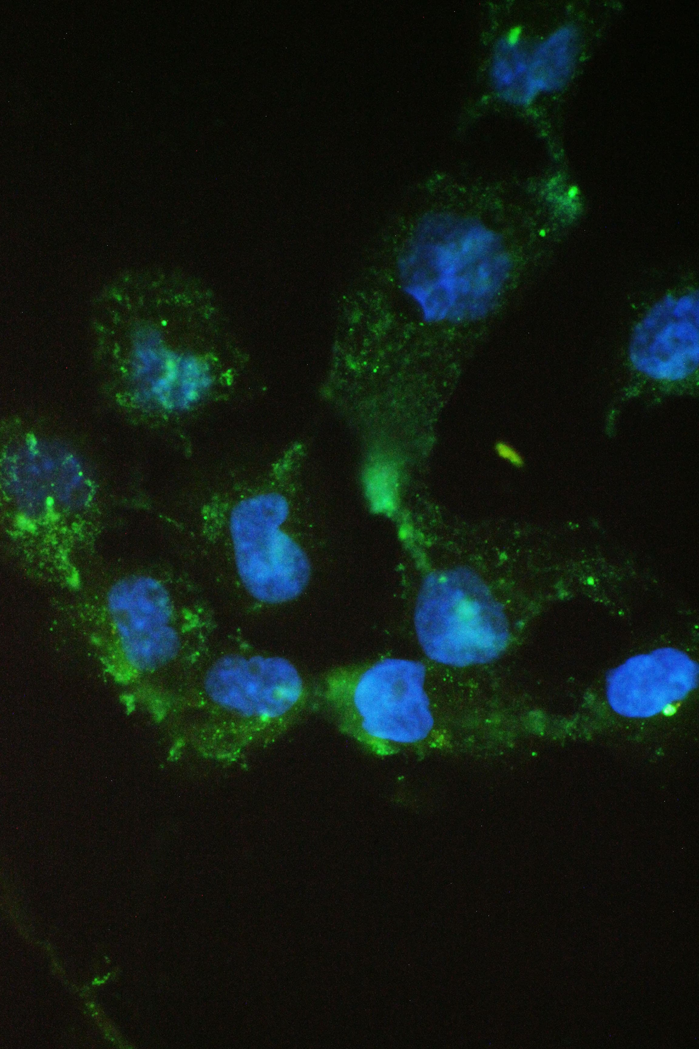 Polyclonal Rabbit anti-Human SCNN1A / ENaC Alpha Antibody (WB)