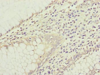 IL1F9 Antibody