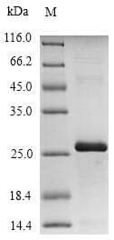 Quail Ovomucoid / Gal d 1 Protein (Recombinant 10His-SUMO, N-terminus + Myc, C-terminus)