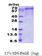 Human FARSB Protein (Recombinant His)