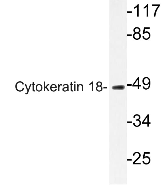 KRT18 / CK18 / Cytokeratin 18 Antibody (Ser48)