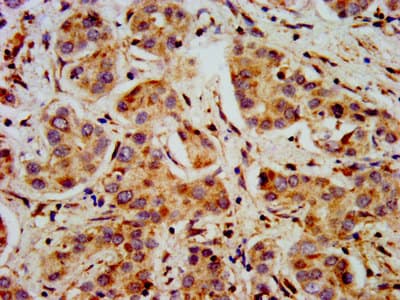 SHANK2 / SHANK Antibody