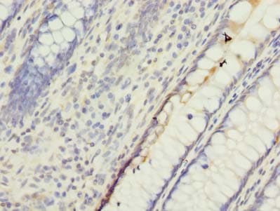 UBQLNL Antibody