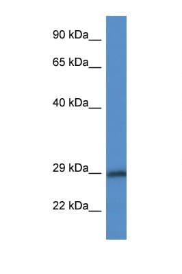 15-PGDH / HPGD Antibody (aa67-116)