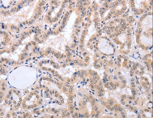 Polyclonal Rabbit anti-Human FADD Antibody (IHC)