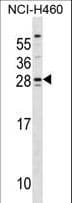 Polyclonal Rabbit anti-Human SH3BGR Antibody (aa149-177, WB)