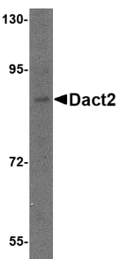 IHC-plus™ DPR2 / DACT2 Antibody