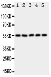 HYAL2 Antibody (aa142-157)