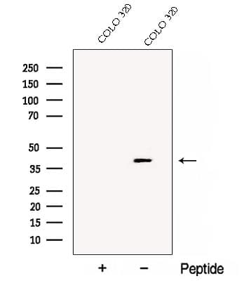DDAH2 Antibody
