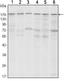 Monoclonal Mouse anti-Human ESET / SETDB1 Antibody (clone 5H6D4, WB)