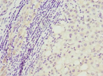 TP53AIP1 / p53 AIP1 Antibody