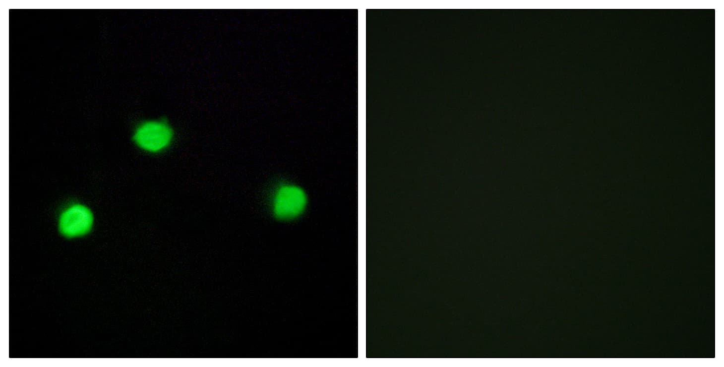 IHC-plus™ IP6K2 Antibody (aa161-210)