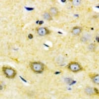 CYP2W1 Antibody (Internal)