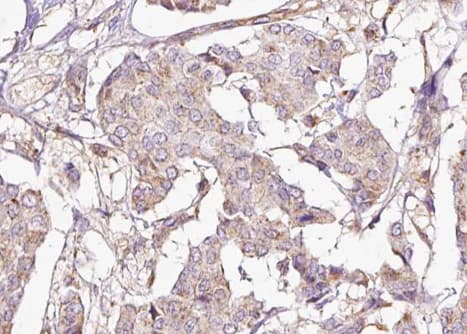 PPP1R1B / DARPP-32 Antibody (phospho-Thr75)