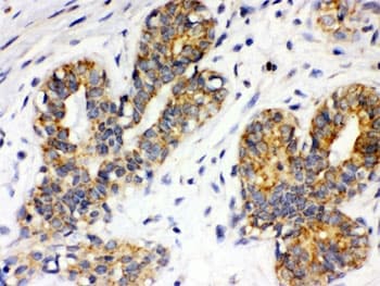 Polyclonal Rabbit anti-Human ITGA4 / VLA-4 / CD49d Antibody (IHC, WB)