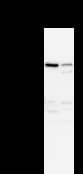 ANKRD11 Antibody (clone 2022C8a)