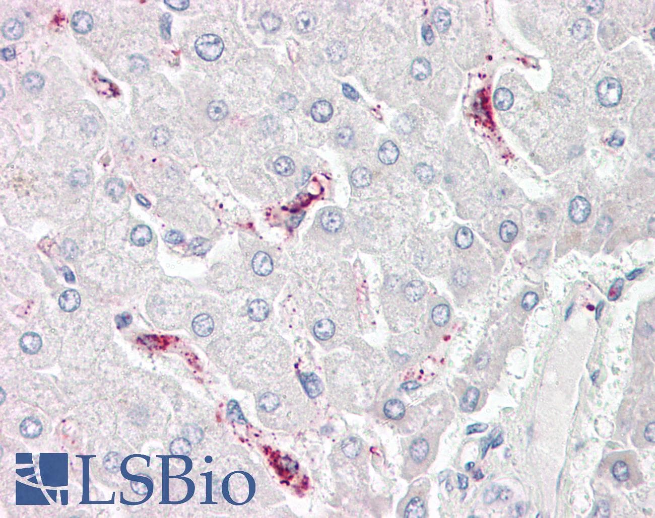 LBP Antibody (aa401-450)