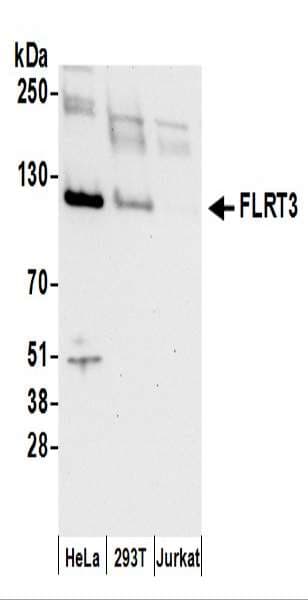 Polyclonal Rabbit anti-Human FLRT3 Antibody (aa375-425, WB)