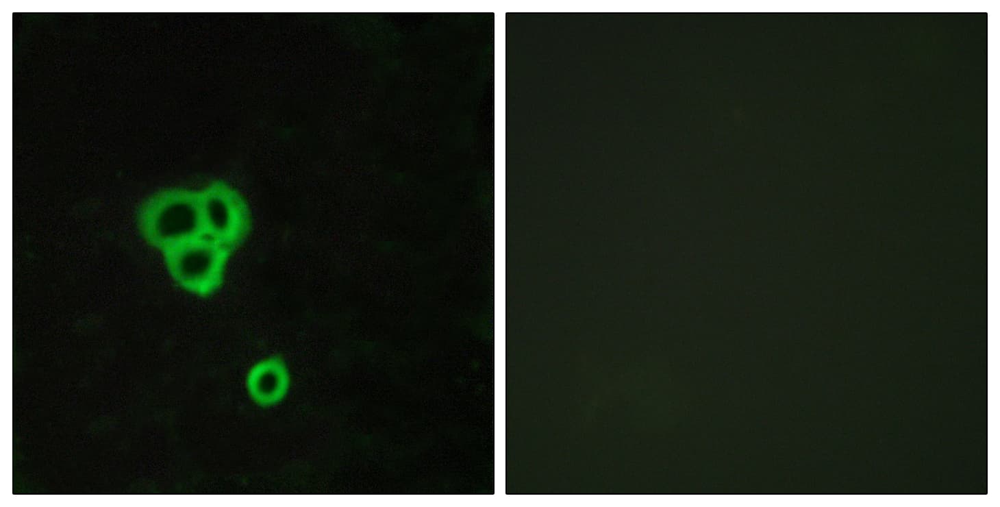 IHC-plus™ GPR119 Antibody (aa186-235)