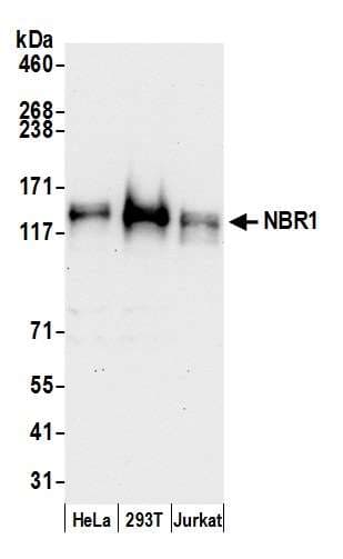 Polyclonal Rabbit anti-Human NBR1 Antibody (aa916-966, WB)