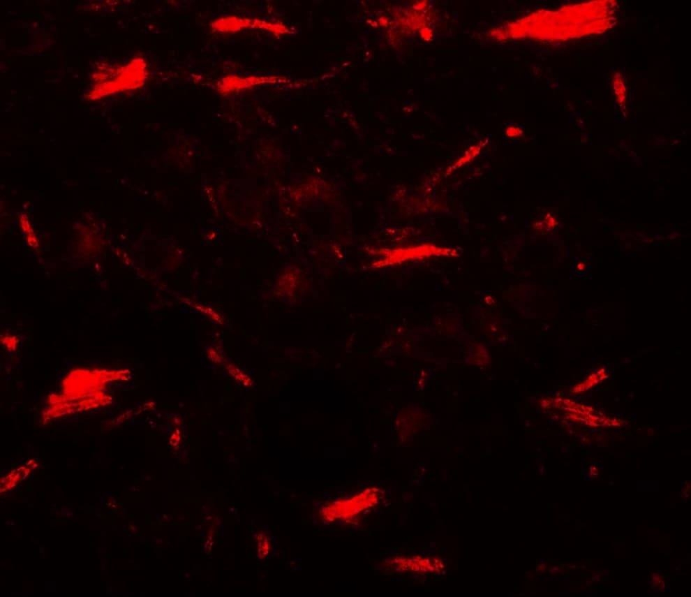 LAMTOR3 / MP1 Antibody