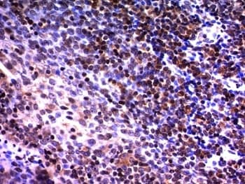 NUMA1 / NUMA Antibody (clone A73-B/D12)