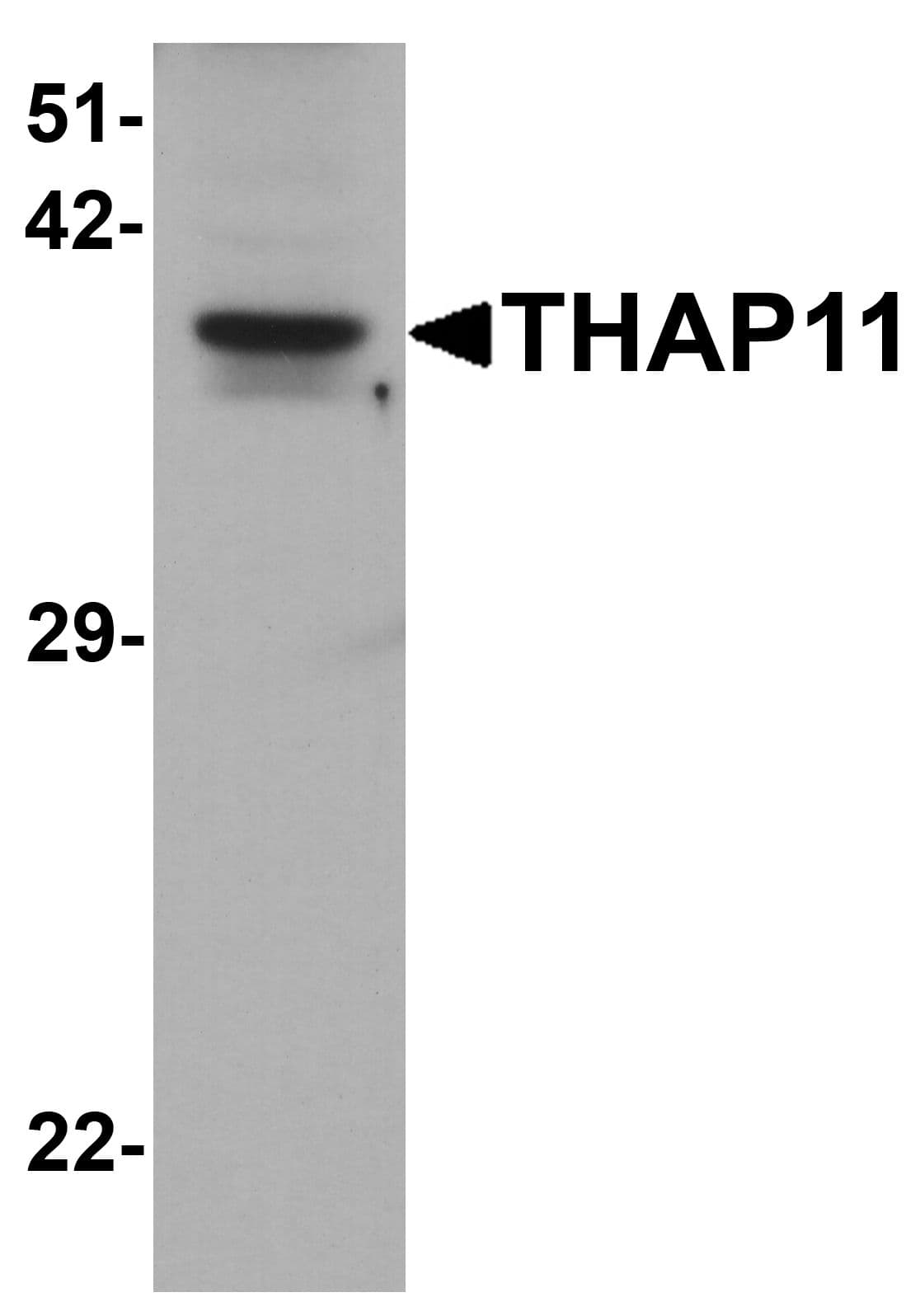 IHC-plus™ CTG-B45d / THAP11 Antibody