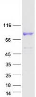 Human C17orf70 Protein (Recombinant Myc-DDK (Flag))